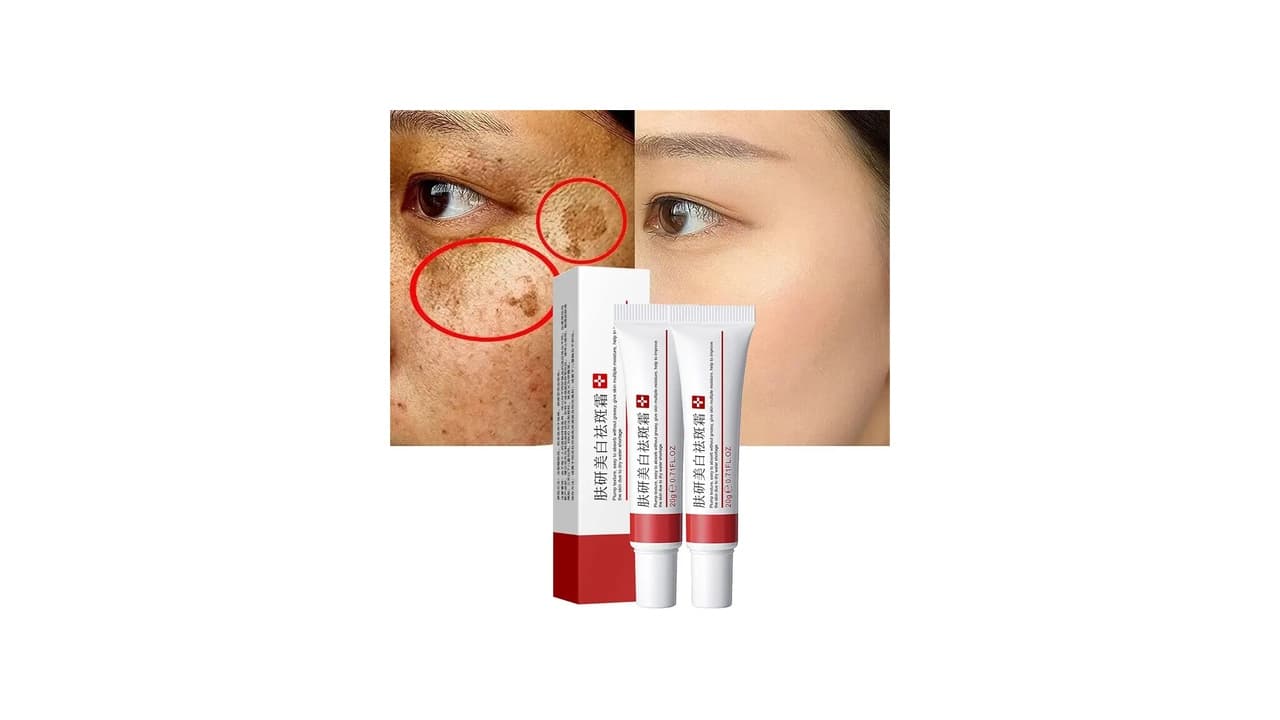 Qual o Melhor Creme Caseiro para Melasma no Rosto? 7 Opções Top Avaliadas